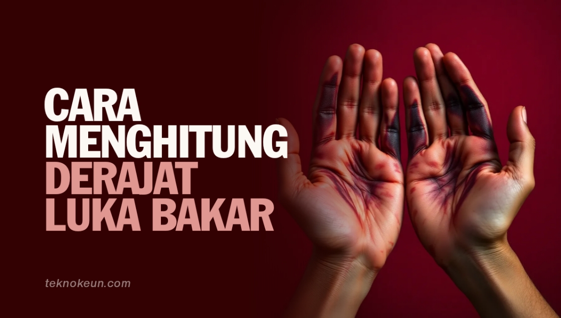 Cara Menghitung Derajat Luka Bakar